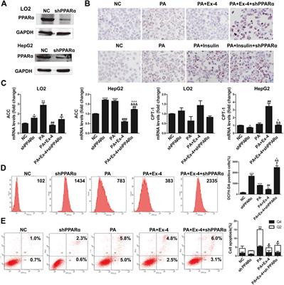 Liraglutide Alleviates Hepatic Steatosis and Liver Injury in T2MD Rats via a GLP-1R Dependent AMPK Pathway